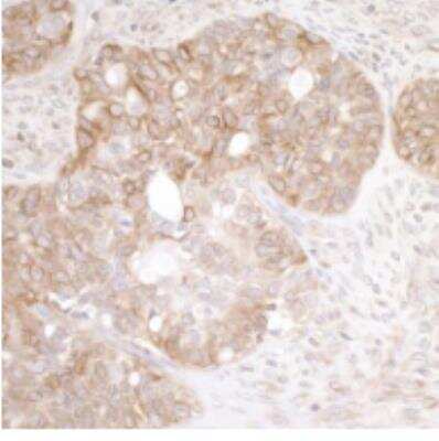 Immunohistochemistry-Paraffin: EML4 Antibody [NBP1-05973]