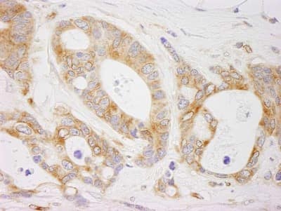 Immunohistochemistry-Paraffin: EML4 Antibody [NBP1-05974]