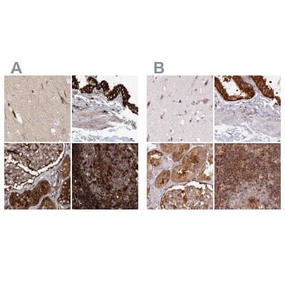 Immunohistochemistry-Paraffin: EML4 Antibody [NBP1-86805]