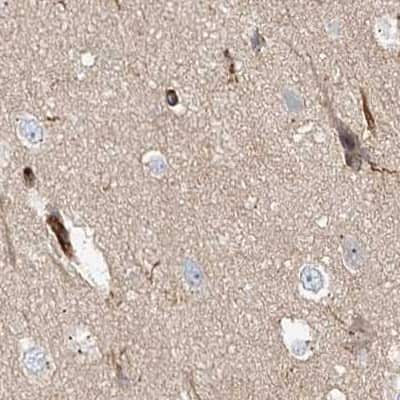 Immunohistochemistry-Paraffin: EML4 Antibody [NBP1-86805]