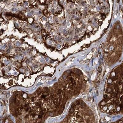 Immunohistochemistry-Paraffin: EML4 Antibody [NBP1-86805]