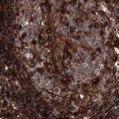 Immunohistochemistry-Paraffin: EML4 Antibody [NBP1-86805]