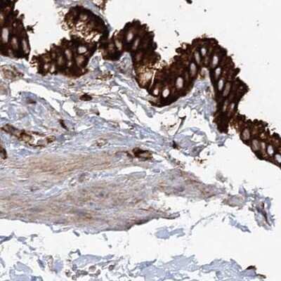 Immunohistochemistry-Paraffin: EML4 Antibody [NBP1-86805]