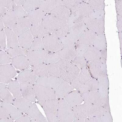 Immunohistochemistry-Paraffin: EML4 Antibody [NBP2-38319]