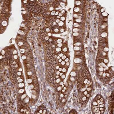 Immunohistochemistry-Paraffin: EML4 Antibody [NBP2-38319]