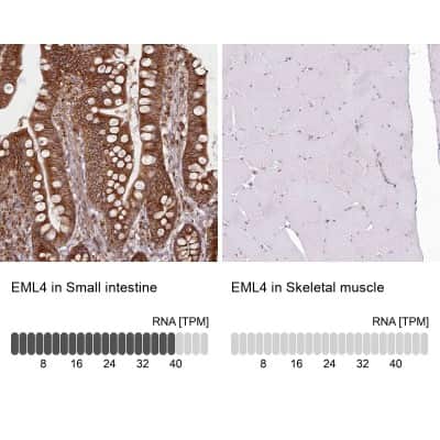 Immunohistochemistry-Paraffin: EML4 Antibody [NBP2-38319]