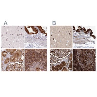 Immunohistochemistry-Paraffin: EML4 Antibody [NBP2-38319]