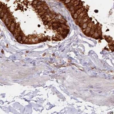Immunohistochemistry-Paraffin: EML4 Antibody [NBP2-38319]