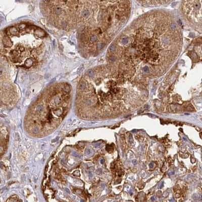 Immunohistochemistry-Paraffin: EML4 Antibody [NBP2-38319]