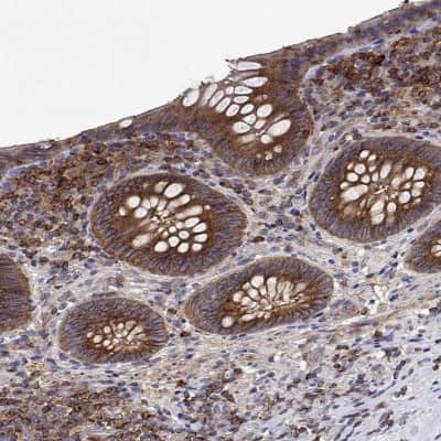 Immunohistochemistry-Paraffin: EML4 Antibody [NBP2-39055]