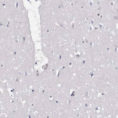 Immunohistochemistry-Paraffin: EML4 Antibody [NBP2-39055]