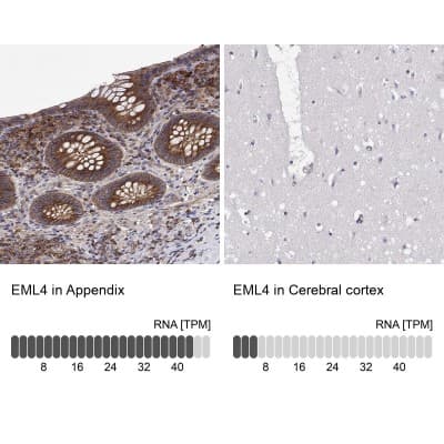 Immunohistochemistry-Paraffin: EML4 Antibody [NBP2-39055]