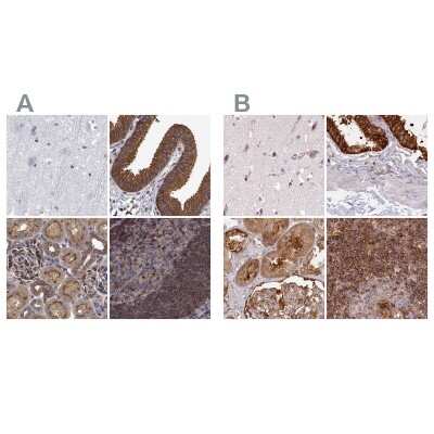 Immunohistochemistry-Paraffin: EML4 Antibody [NBP2-39055]