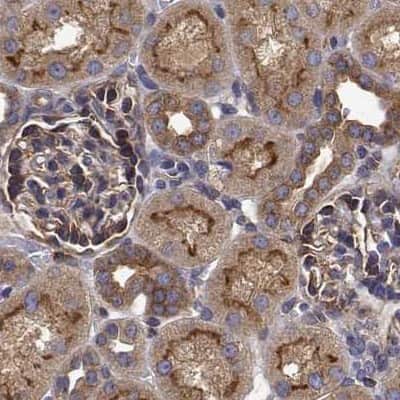 Immunohistochemistry-Paraffin: EML4 Antibody [NBP2-39055]