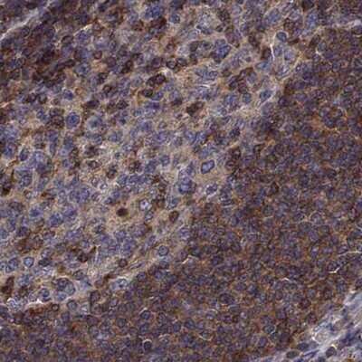 Immunohistochemistry-Paraffin: EML4 Antibody [NBP2-39055]