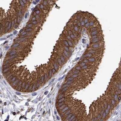 Immunohistochemistry-Paraffin: EML4 Antibody [NBP2-39055]