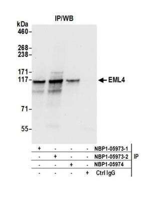 Immunoprecipitation: EML4 Antibody [NBP1-05973]