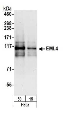 Western Blot: EML4 Antibody [NBP1-05973]