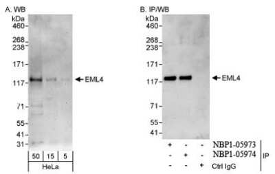 Western Blot: EML4 Antibody [NBP1-05974]