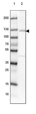 Western Blot: EML4 Antibody [NBP2-39055]