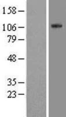 Western Blot: EML4 Overexpression Lysate [NBL1-10258]