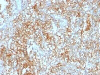 Immunohistochemistry-Paraffin: EMMPRIN/CD147 Antibody (8D6) - Azide and BSA Free [NBP2-34543]