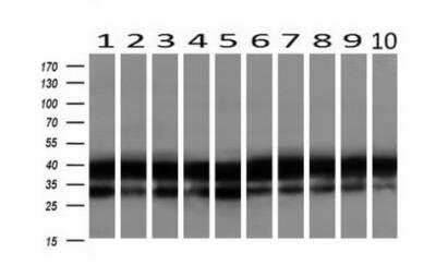 Western Blot: EMMPRIN/CD147 Antibody (OTI9H5) [NBP2-02534]