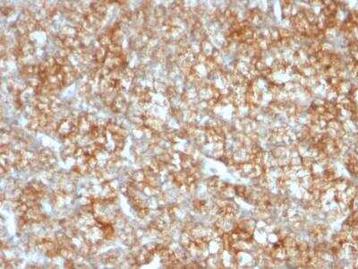 Immunohistochemistry-Paraffin: EMMPRIN/CD147 Antibody (BSG/963) - IHC-Prediluted [NBP2-48222]