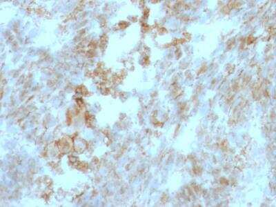 Immunohistochemistry-Paraffin: EMMPRIN/CD147 Antibody (BSG/963) - IHC-Prediluted [NBP2-48222]