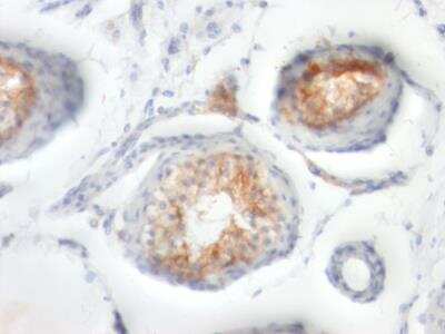 Immunohistochemistry-Paraffin: EMMPRIN/CD147 Antibody (BSG/963) - IHC-Prediluted [NBP2-48222]