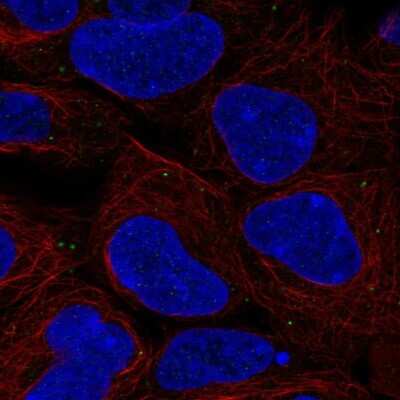Immunocytochemistry/ Immunofluorescence: EMMPRIN/CD147 Antibody [NBP2-57810]