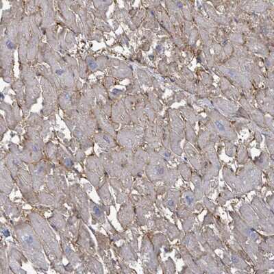 Immunohistochemistry-Paraffin: EMMPRIN/CD147 Antibody [NBP2-34025]