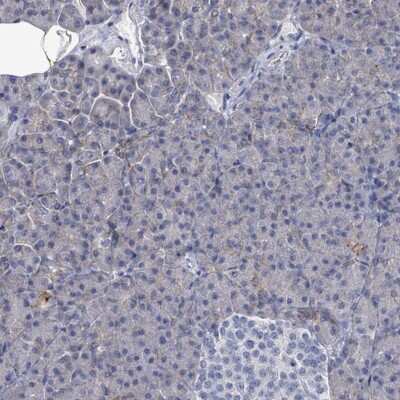Immunohistochemistry-Paraffin: EMMPRIN/CD147 Antibody [NBP2-34025]