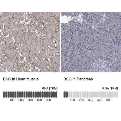 Immunohistochemistry-Paraffin: EMMPRIN/CD147 Antibody [NBP2-34025]