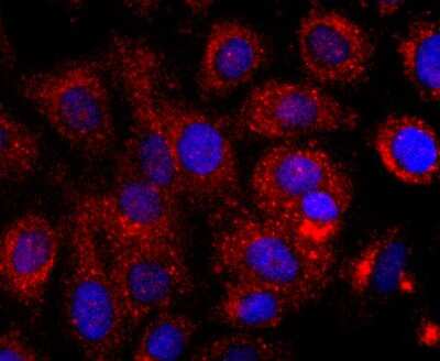 Immunocytochemistry/ Immunofluorescence: EMMPRIN/CD147 Antibody (JF1-045) [NBP2-66820]