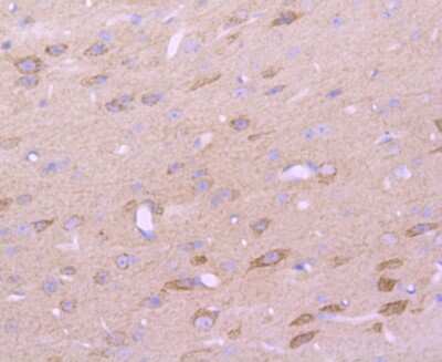 Immunohistochemistry-Paraffin: EMMPRIN/CD147 Antibody (JF1-045) [NBP2-66820]