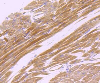 Immunohistochemistry-Paraffin: EMMPRIN/CD147 Antibody (JF1-045) [NBP2-66820]