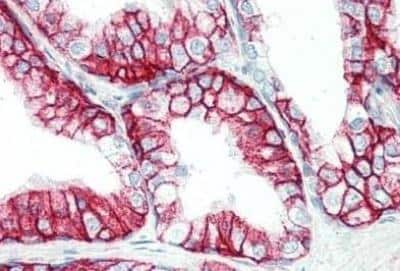 Immunohistochemistry-Paraffin: EMMPRIN/CD147 Antibody (MEM-M6/1) - BSA Free [NB500-430]