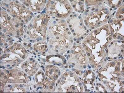 Immunohistochemistry: EMMPRIN/CD147 Antibody (OTI9H5) - Azide and BSA Free [NBP2-70278]