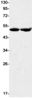 Western Blot: EMMPRIN/CD147 Antibody (S04-5B3) [NBP3-20062]