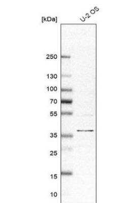 Western Blot: EMMPRIN/CD147 Antibody [NBP2-34025]