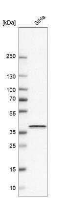 Western Blot: EMMPRIN/CD147 Antibody [NBP2-57810]