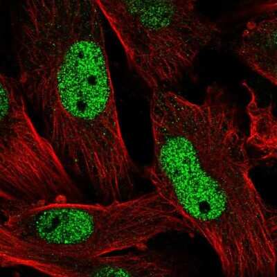 Immunocytochemistry/ Immunofluorescence: EMP/MAEA Antibody [NBP2-55034]