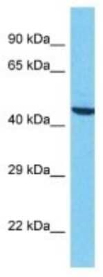 Western Blot: EMP/MAEA Antibody [NBP3-10675]