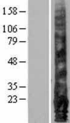 Western Blot: EMP1 Overexpression Lysate [NBL1-10259]