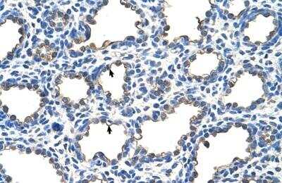 Immunohistochemistry-Paraffin: EMP2 Antibody [NBP1-62705]