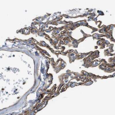Immunohistochemistry-Paraffin: EMP2 Antibody [NBP1-86847]