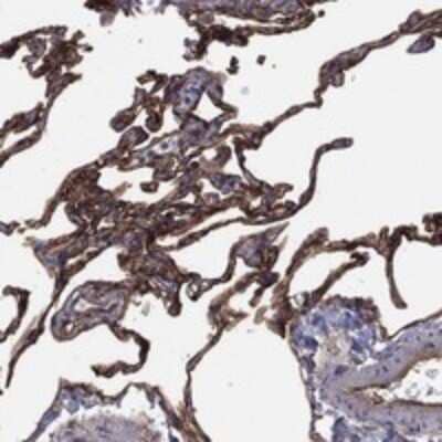 Immunohistochemistry-Paraffin: EMP2 Antibody [NBP3-17361]