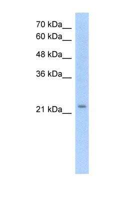 Western Blot: EMP2 Antibody [NBP1-62705]