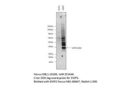 Western Blot: EMP2 Overexpression Lysate [NBL1-10260]